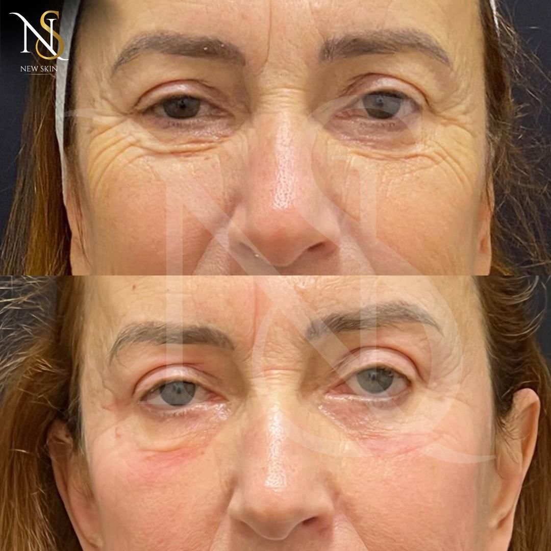 1e030ff8-1b7b-4545-b2e9-dc2eea0c293e