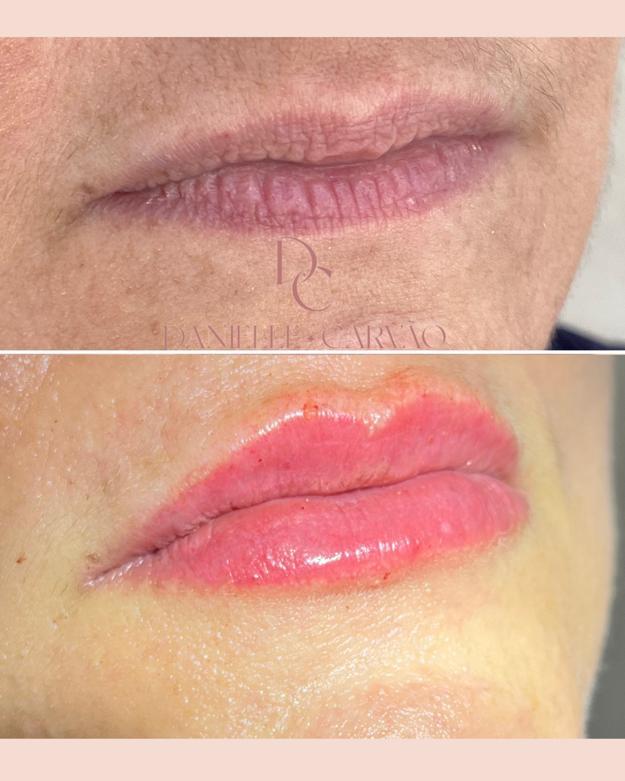 5a135881-567d-4f79-bc66-8da2e63661f9