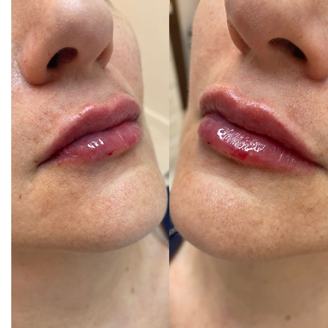 864d3fa4-686d-4dbd-aac4-d64dcd194065